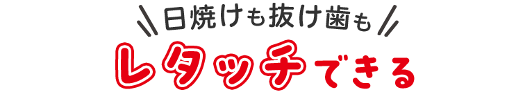 日焼けも抜け歯もレタッチできる